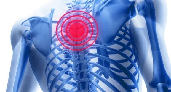 Treatment of osteocondrosis of the thoracic back