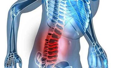 Signs and symptoms of lumbar -skintochondrosis