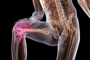 joint pain due to osteoarthritis of the knee